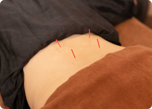 写真：施術の様子