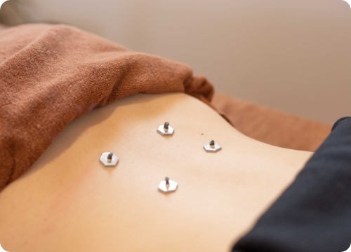 写真：施術の様子