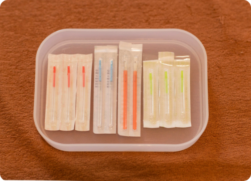 写真：施術の様子